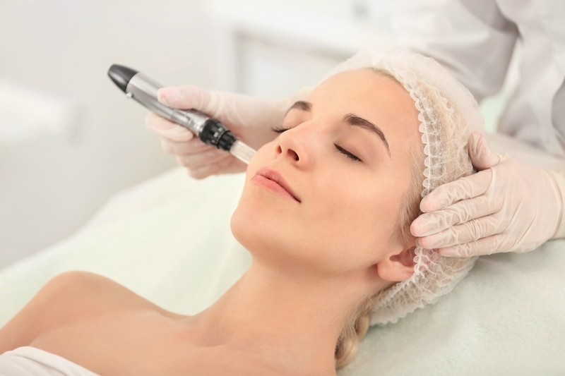 Khi thực hiện phi kim, bạn sẽ được ủ tê để giảm đau