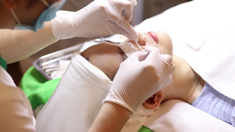Câu trả lời cho nặn mụn có nên ủ tê không là không nên
